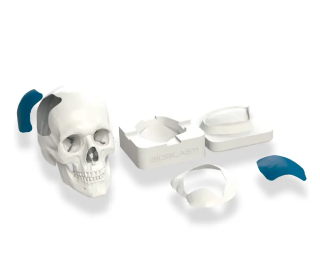 protese-craniana-cranioplastia-1